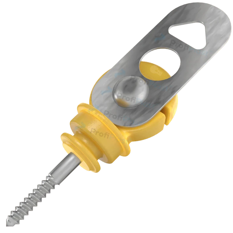 Engate batente isolado para porteira - Detalhe do produto 16